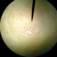 Penic Videos | Photobucket